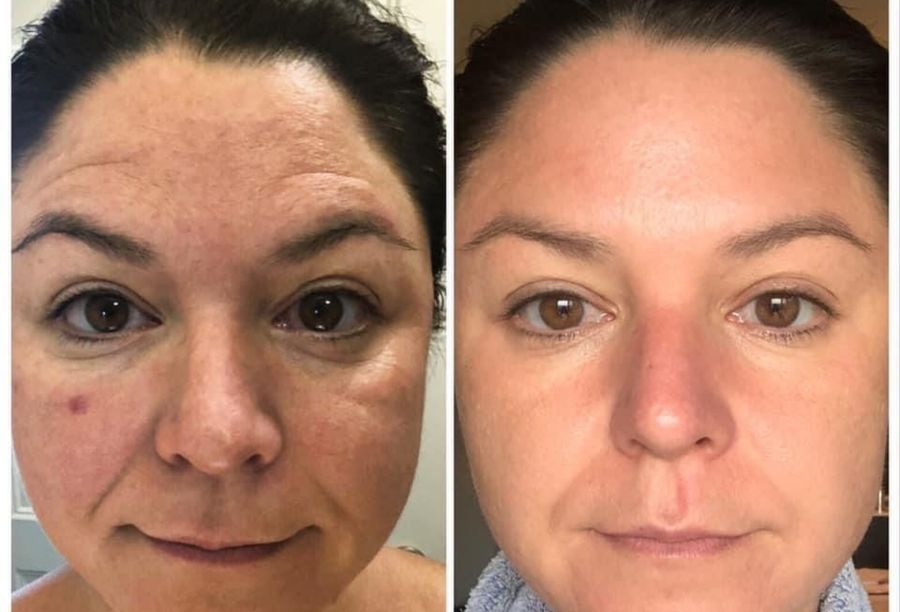 Before / After